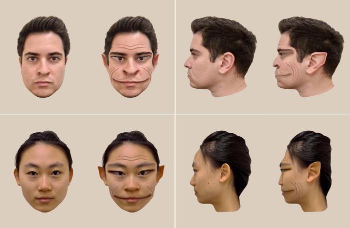 4 x het vervormde gezicht aan de rechterkant zoals een 58-jarige PMO patiënt het ziet. De linkerkant is het daadwerkelijke gezicht. (man, vrouw, vooraanzicht, zijaanzicht.)